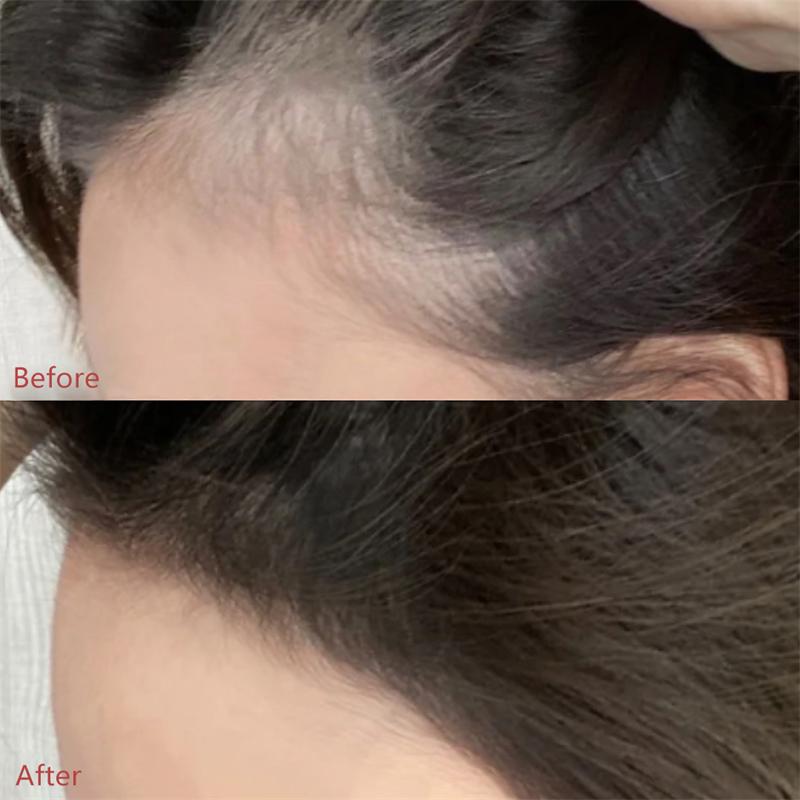 MagicPowder™ – For naturally fuller & confident-looking hair