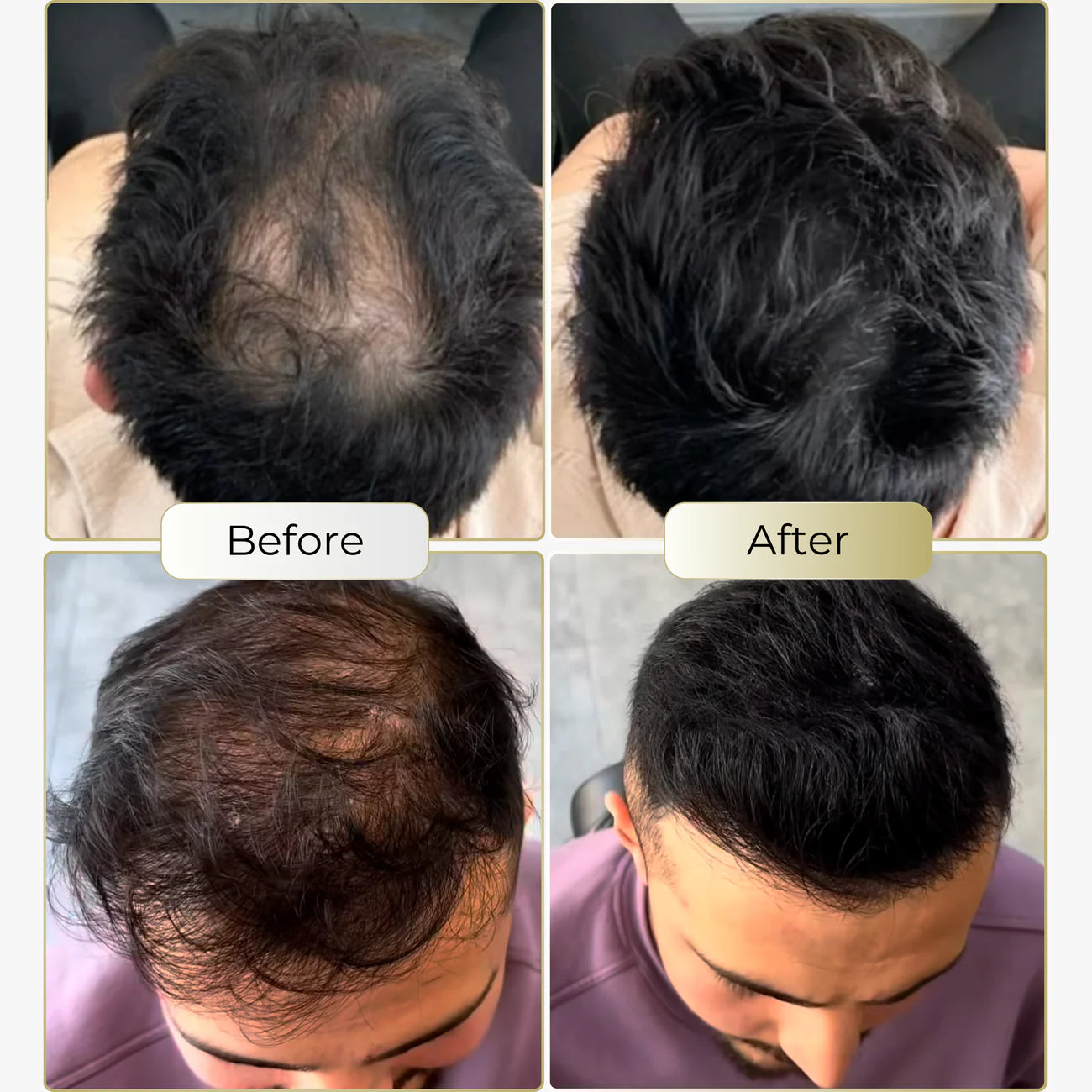 MagicColour™ – For naturally fuller & confident-looking hair