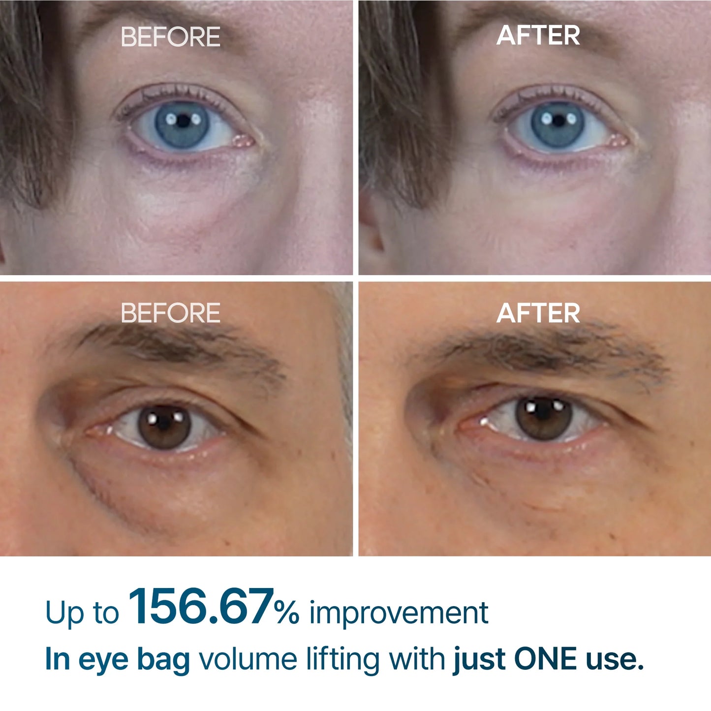 MagicColour™ - Eyephalt Eyebag Cream