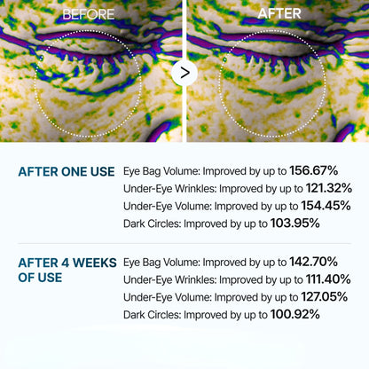 MagicColour™ - Eyephalt Eyebag Cream