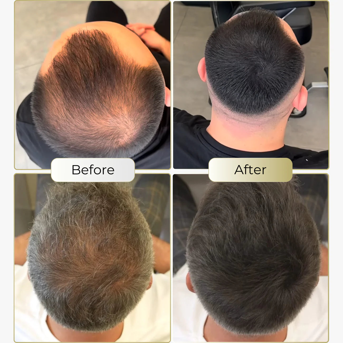 MagicColour™ – For naturally fuller & confident-looking hair